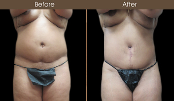 20202608153144_B89-Front-Template